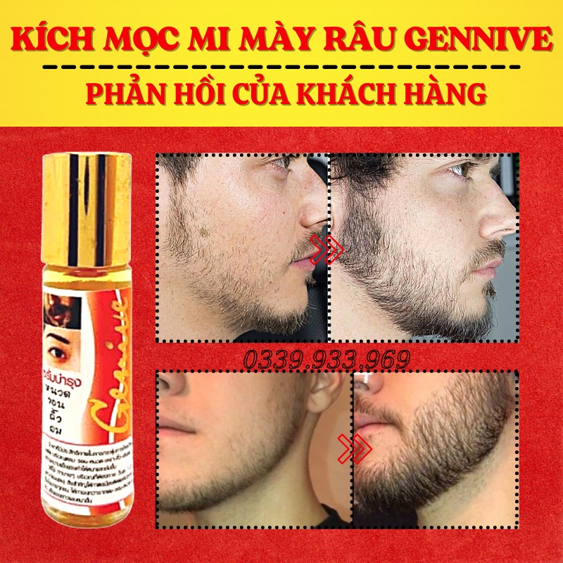 (HOT) Serum Mọc Dày Mi, Lông Mày, Râu Genive