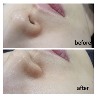 Serum B5 Phục hồi cấp ẩm GOODNDOC