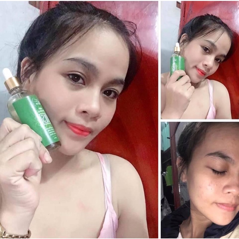 SERUM NGỌC LINH SÂM TẶNG BỘT RỬA MẶT LOẠI BỎ MỤN NÁM TÀN NHANG