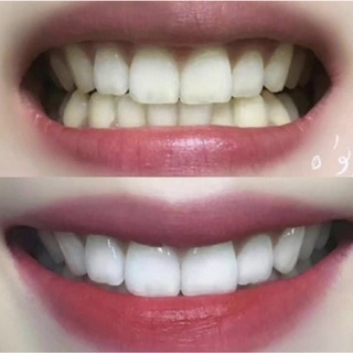 KEM ĐÁNH RĂNG CREST 3D WHITE ADVANCED 158gr HÀNG MỸ CHUẨN AUTHENTIC