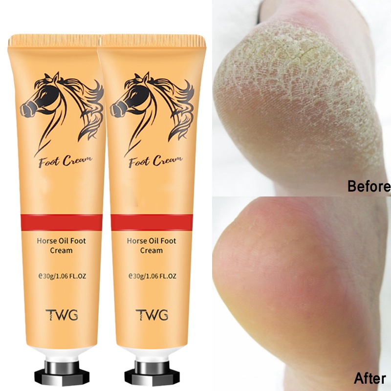 Kem Dưỡng Ẩm Da Chân Chống Nứt Nẻ Dành Cho Đi Du Lịch Ngoài Trời