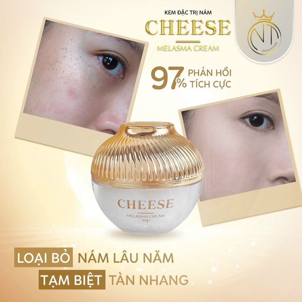 Kem Face nám cheese NT Cosmetics 20g chiết xuất hoa nhung tuyết mờ thâm Nám giảm nhăn ngừa lão hóa