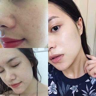 Mặt nạ detox blanc trắng da-thải độc chì