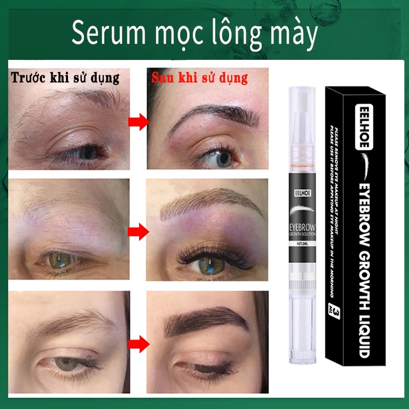 Serum mọc lông mày