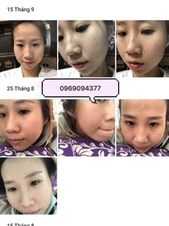 Đông y tái tạo da handmade