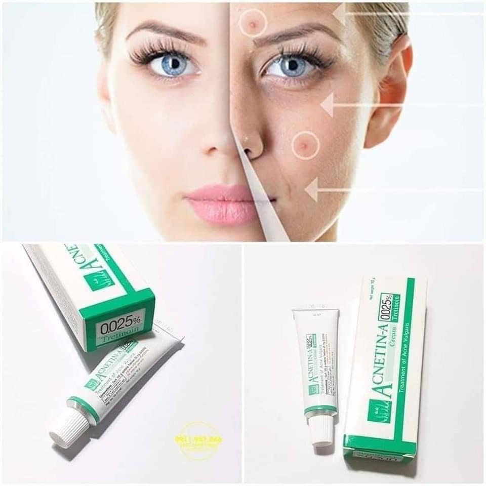 Kem Đẩy Mụn Ẩn, Kem Dưỡng Trẻ Hóa Da Acnet Tretinoin Thái Lan - Retin A (Mẫu Mới)