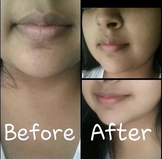 Tẩy da chết môi Cherry Scrub | BigBuy360 - bigbuy360.vn