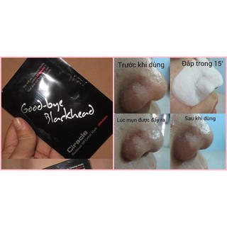 Miếng đẩy mụn đầu mụn Goodbye Blackhead Ciracle
