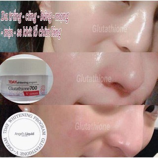 Glutathion - Tinh chất trắng da