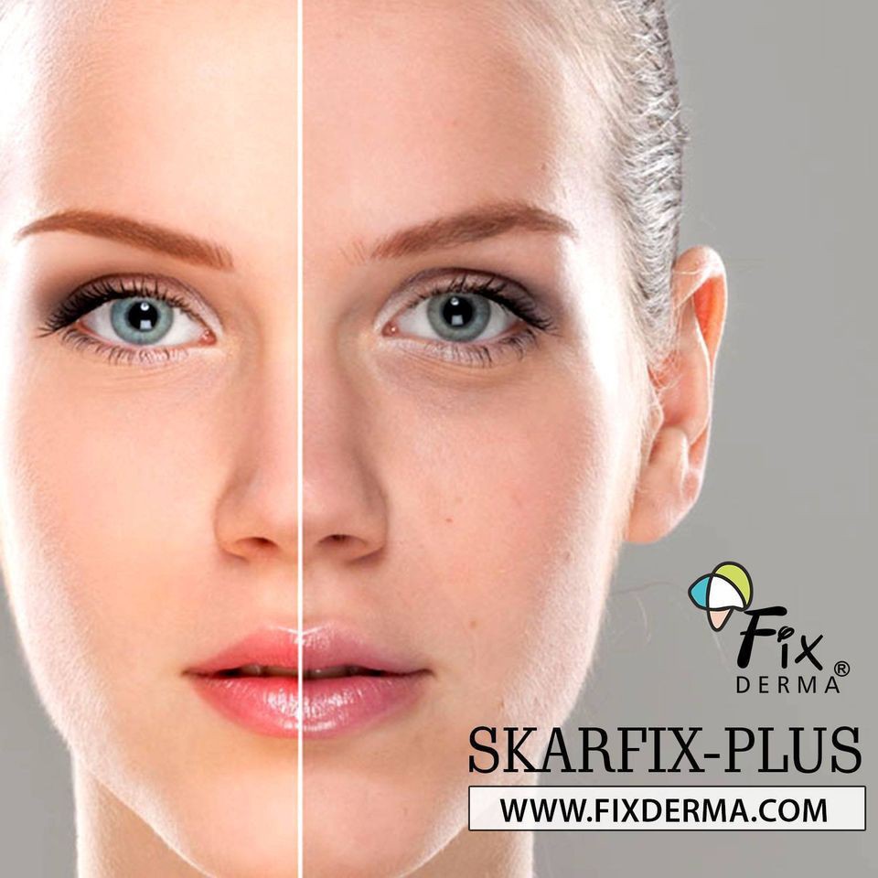 Fixderma Skarfix tx Cream - Kem dưỡng da mờ nám, giảm thâm | BigBuy360 - bigbuy360.vn