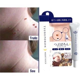 Kem xóa nốt ruồi Nhật TSUBUPORON 20g