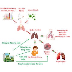 Giải độc phổi BoniDetox (Hộp 30 viên) Chính hãng Botania