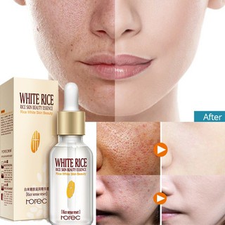 Serum gạo trắng da giúp giữ ẩm và trẻ hoá da Rorec