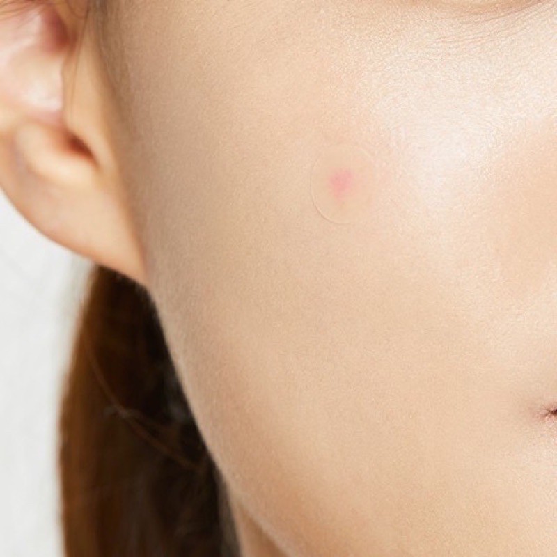 Miếng dán mụn Cosrx 24 miếng Acne Pimple Master Patch | BigBuy360 - bigbuy360.vn