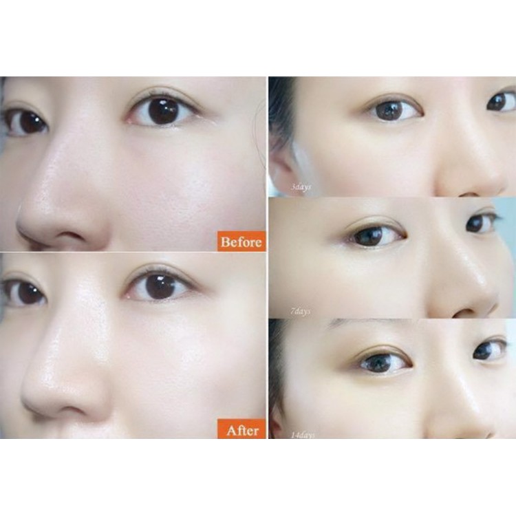 Bộ đôi cấp ẩm, làm sáng đẹp da Innerb Aqua Rich lọ 70 viên&nước uống Collagen hộp 6 chai | BigBuy360 - bigbuy360.vn