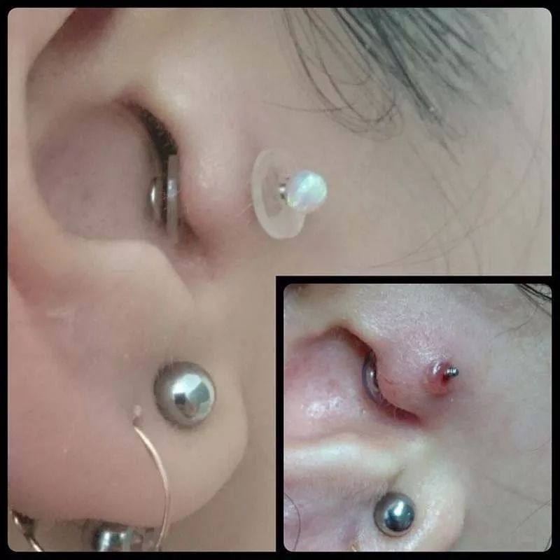 Miếng nẹp giảm bump, chống sưng