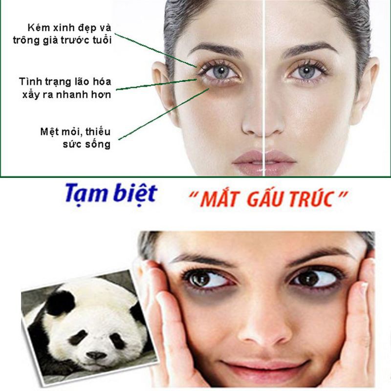 Kem Giảm Quầng Thâm Mắt Nga Klirvin 20g