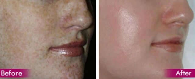 Acid malic làn da trắng sáng 10g