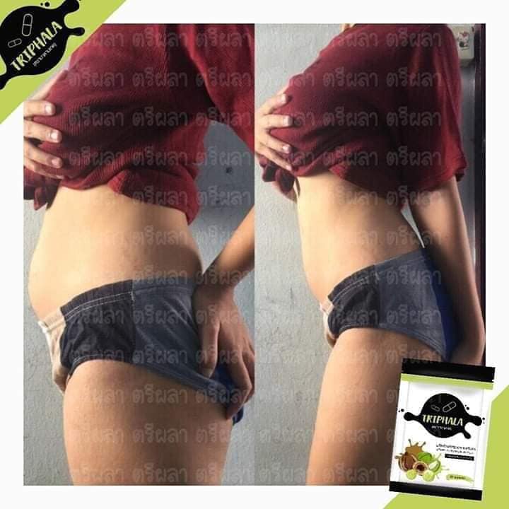 Uống Thải Mỡ Detox Triphala