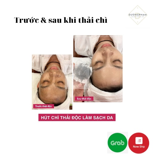Viên Thải Chì Haosani Hàng Chuẩn Loại 1