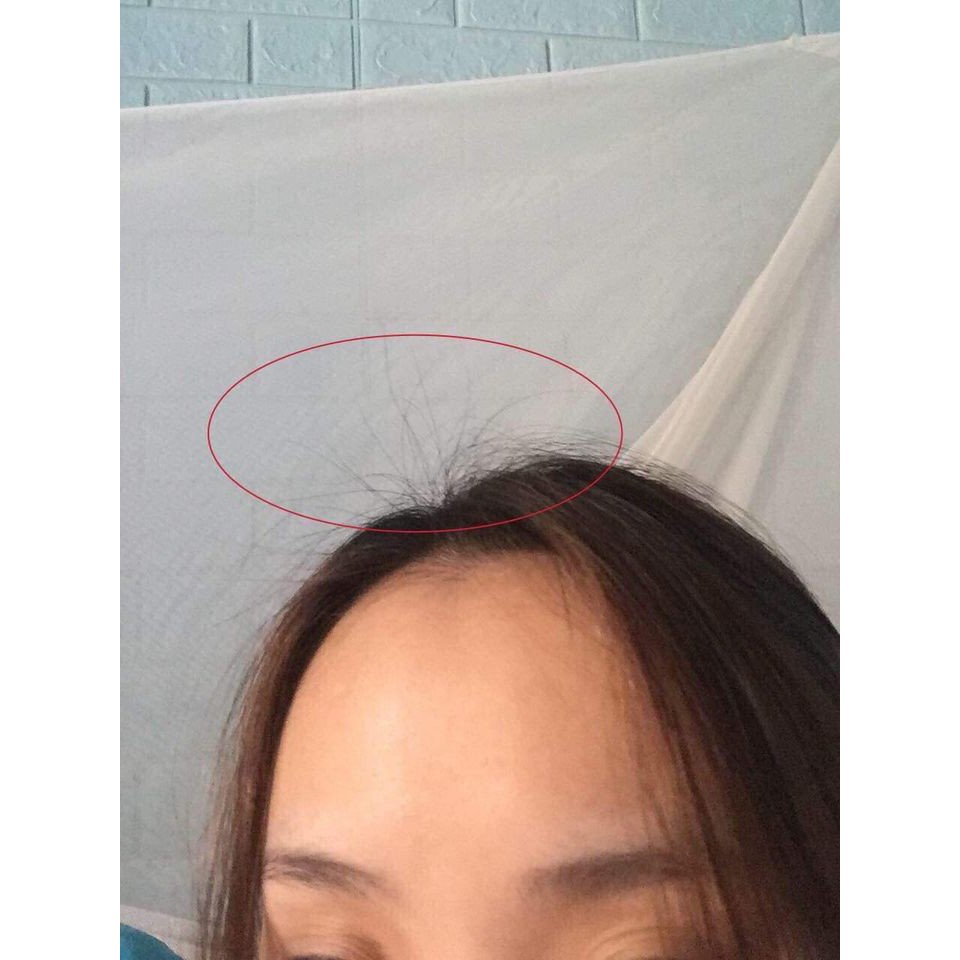 Tinh dầu bưởi Vi Jully Kích Thích Mọc Tóc Và Giảm Rụng Tóc | BigBuy360 - bigbuy360.vn