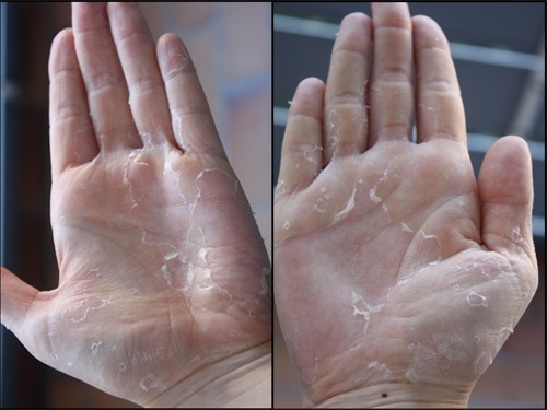 [Chính hãng] Nước rửa chén hữu cơ không hại da tay COMEON