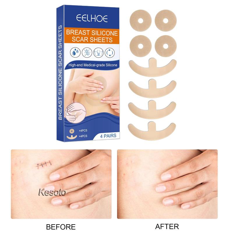 Miếng Dán Silicone Hỗ trợ giảm sẹo Nhanh Chóng Cho Keloid