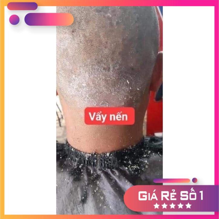 Kem bôi da kem bôi tổ đỉa ghẻ nước nấm ngứa các loại, thảo dược tự nhiên