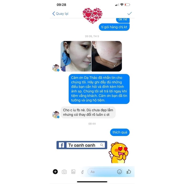 Kem Nuly Baby dưỡng da trắng đẹp
