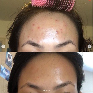 TONER THE ORDINARY GLYCOLIC 7% TONING SOLUTION (Bản Hàn)