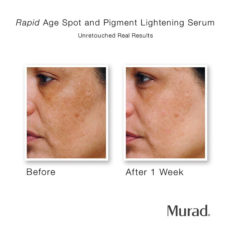 Serum giảm nám Murad - Rapid Age Spot Correcting Serum (Minisize)