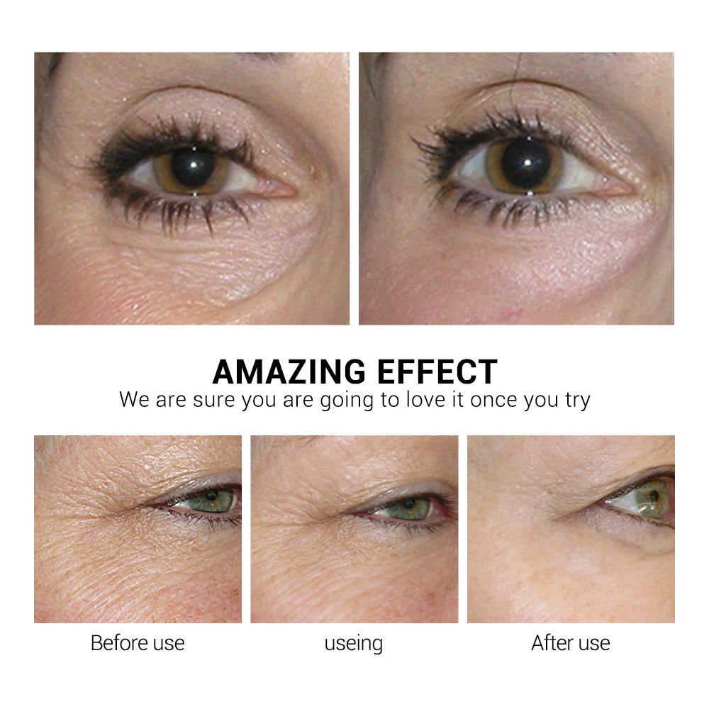(Hàng Mới Về) Hộp 50 Miếng Mặt Nạ Mắt Lanbena Chứa Retinol Chống Bọng Mắt Giảm Quầng Thâm Làm Săn Chắc Da | BigBuy360 - bigbuy360.vn