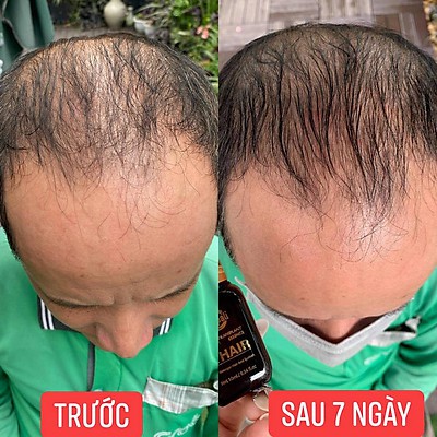 💖CAM KẾT CHÍNH HÃNG💖 Tinh chất dài mi mọc tóc Dr Hair Zenpali