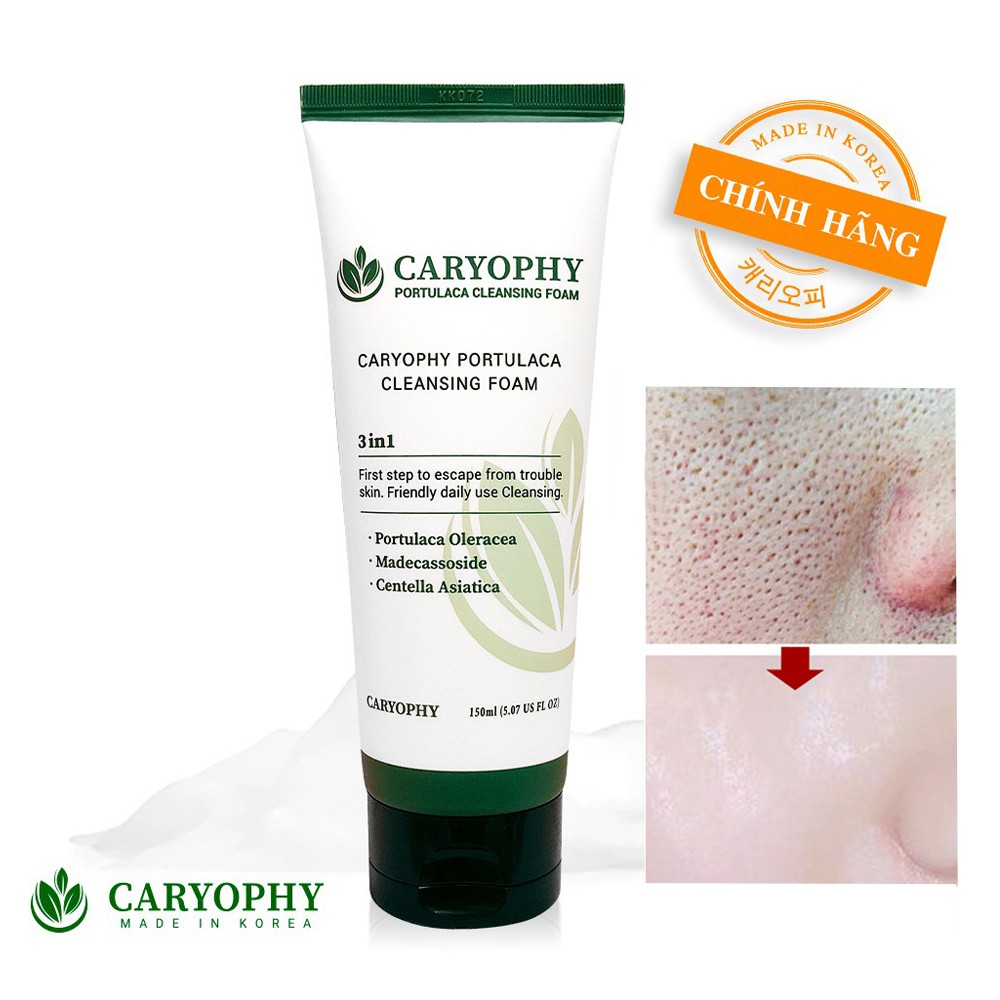 [Nhập Seru0909 Giảm 29k] Sữa Rửa Mặt Trị Mụn Trị Thâm Sạch Nhờn Cho Da Nhạy Cảm Caryophy