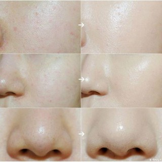 TONER NƯỚC QUÝ EAU PRECIEUSE 375ML