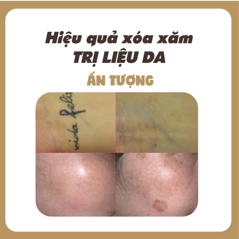 Máy Laser Ruikd 2021