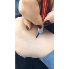 Dung Dịch Xóa Xăm Tức Thì Hiệu Quả Trong 2h DCPX