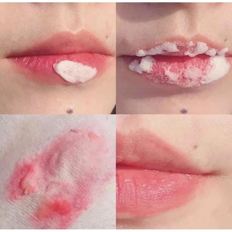 Tẩy tế bào chết môi Bubi Lip mẫu mới