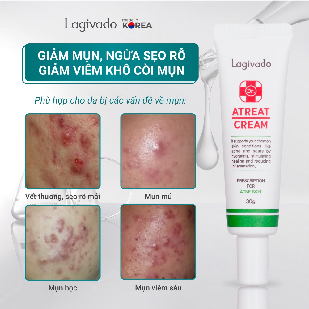 ATREAT CREAM LAGIVADO - Kem giảm mụn, ngăn ngừa thâm sẹo Hydrolyzed sponge 2% 30g