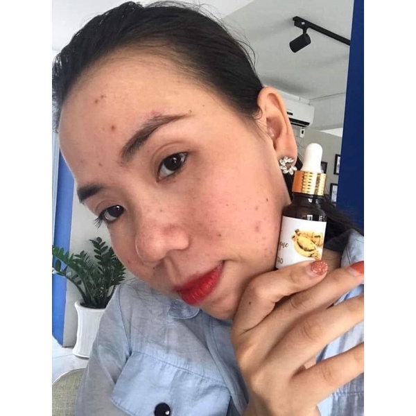 Serum Tái Tạo Da Milk Boutique