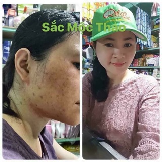 Sắc mộc thảo