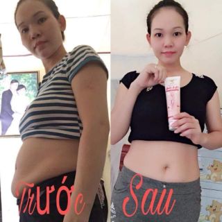 Gel tan mỡ chiết suất gừng quế