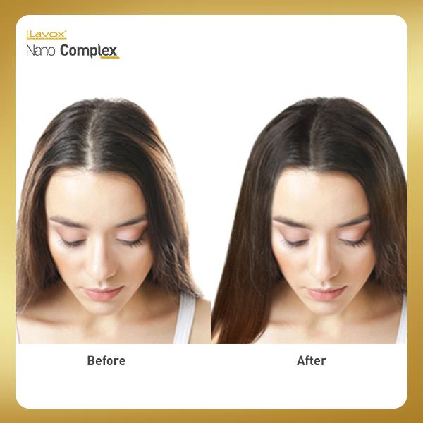 Serum Kích Thích Mọc Tóc Nano Complex