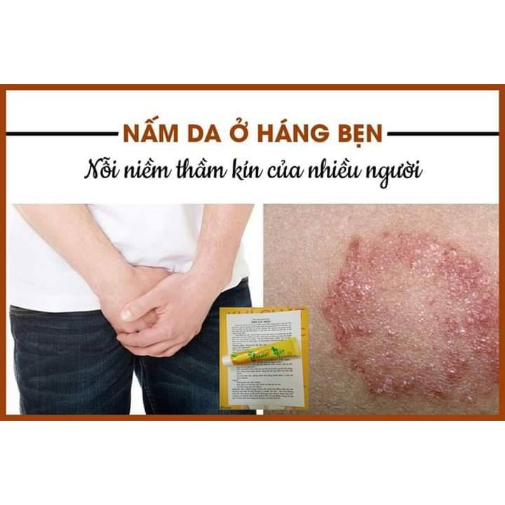 [ CHÍNH HÃNG ] Kem Bôi Da Thuần . Mộc - Thanh Mộc . Hương