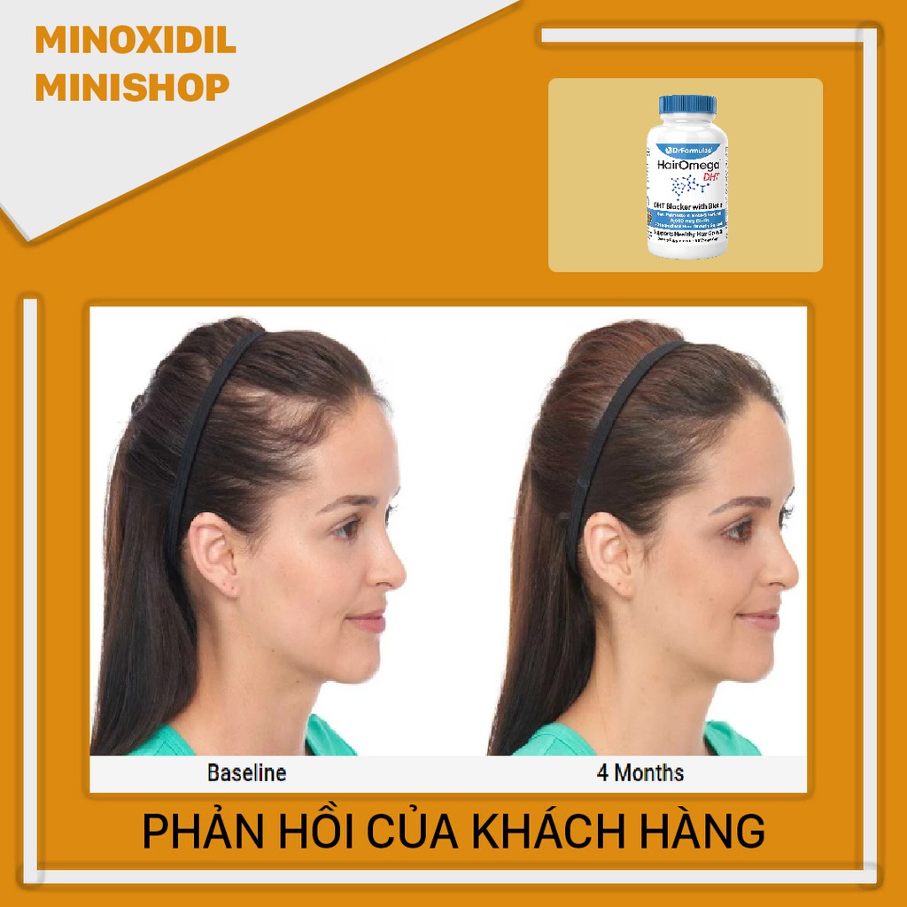 HairOmega DHT Blocker - Mọc Tóc Ngăn Rụng Tóc