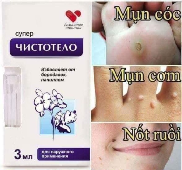 Gel tẩy mụn ruồi, mụn cóc, mụn thịt, sẹo lồi Dvelinil chính hãng