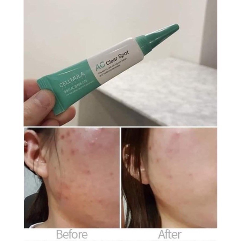 Kem chấm mụn Cellmula AC Clear Spot | BigBuy360 - bigbuy360.vn