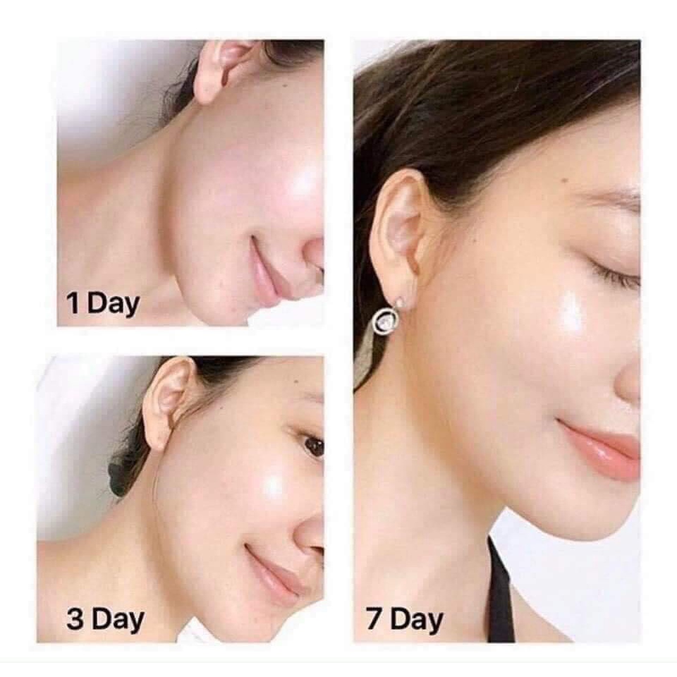 Tinh chất trẻ hóa da Serum Lancome Advanced Genifique Youth Activating Concentrate 10ml tách set