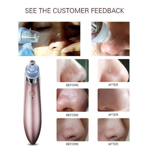 Máy Hút Mụn, Đầu Đen Cám Bọc Cầm Tay Mini Blackhead Spa Hút Nặn Mụn Trứng Cá Tặng 3 Đầu Hút Đa Năng