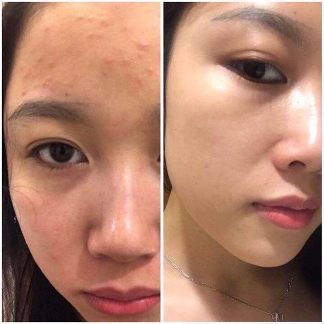 [Sample] Serum dưỡng da ban đêm Kiehls | Tinh chất dưỡng da Kiehl’s Midnight Recovery Concentrat 2ml | BigBuy360 - bigbuy360.vn